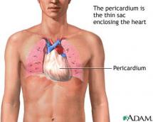 Pericardium and Its Role in a Crucifixion