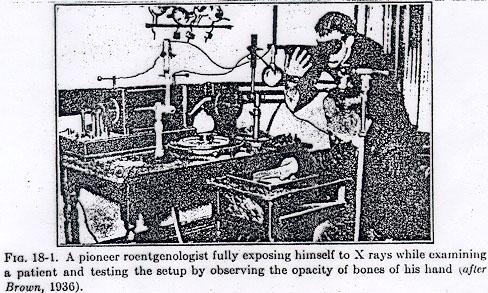 human exposure x ray 1890s human exposure x ray 1890s