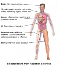 RADIATION SICKNESS